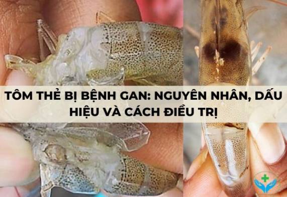 Tôm thẻ bị bệnh gan: Nguyên nhân, dấu hiệu và cách điều trị